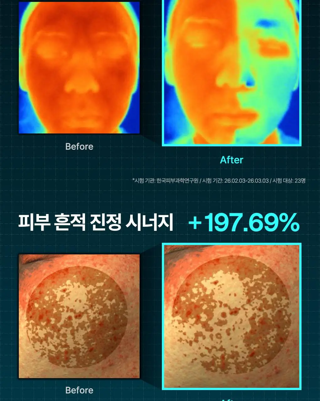 [장도연 PICK] 메디힐 마데카소사이드 흔적 리페어 세럼 40+40ml 상세페이지 3